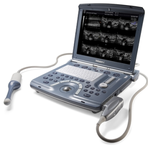 GE Voluson i Portable 3D/4D Ultrasound