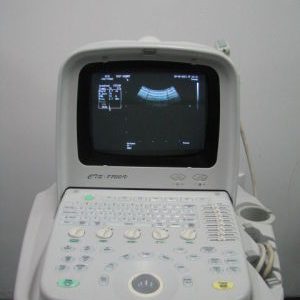 SIUI ULTRASOUND SCANNER CTS7700 PLUS – SIUCTS7700