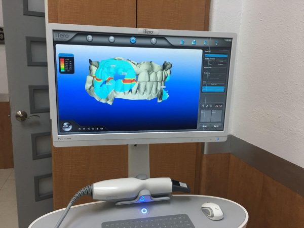 iTero HD2.9 Intraoral Dental Scanner - Image 3