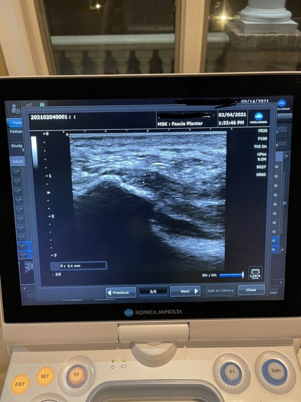 Konica Minolta Sonimage HS1 Portable Ultrasound Machine