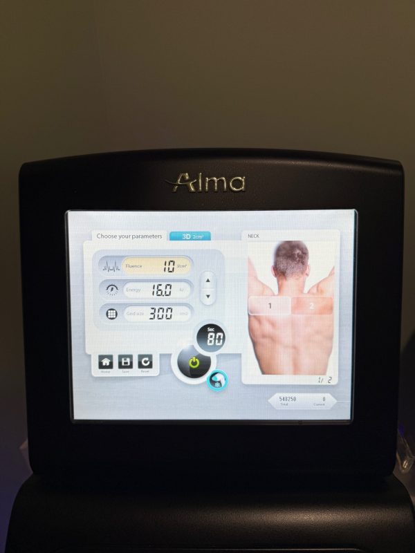 2022 Alma Soprano Ice PLATINUM – WITH 2 HANDPIECES - Image 4