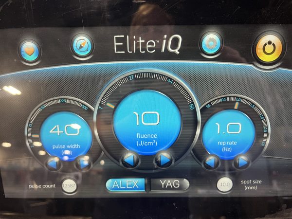 2021 Cynosure Elite IQ – 755nm & 1064nm - Image 4