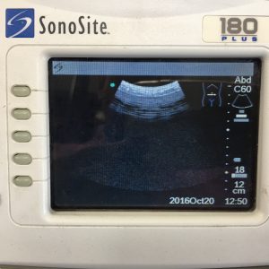 SonoSite 180 Plus Ultrasound System