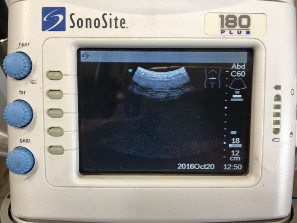 SonoSite 180 Plus Ultrasound System - Image 2