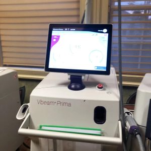 Syneron-Candela Vbeam Prima cosmetic laser