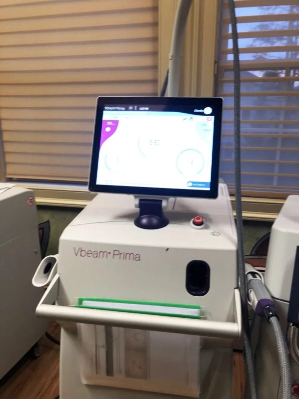 Syneron-Candela Vbeam Prima cosmetic laser