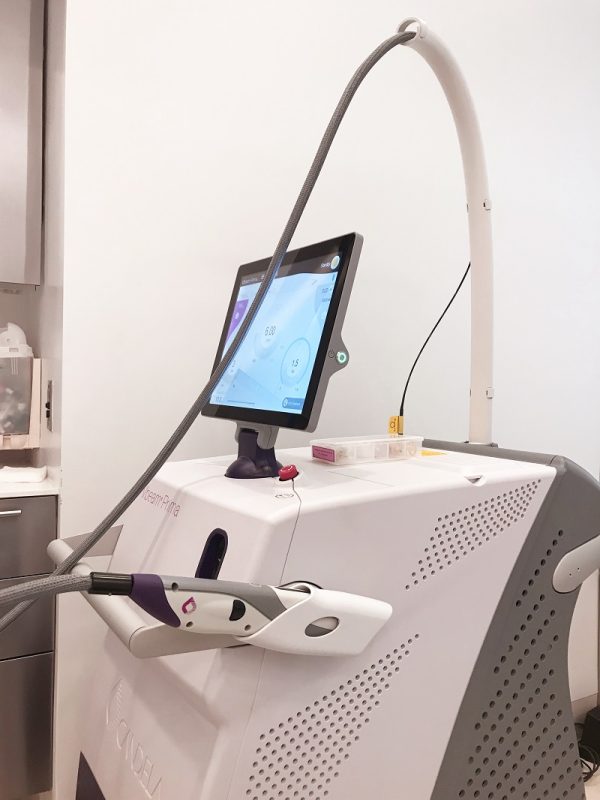 Syneron-Candela Vbeam Prima cosmetic laser - Image 2