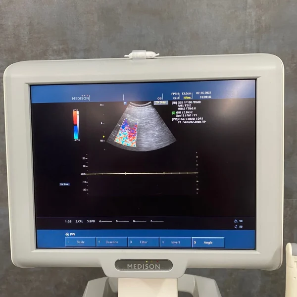 Samsung Medison SonoAce X6 Ultrasound - Image 2
