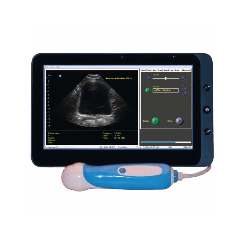 ViewBladder 10-Tablet Ultrasound Imaging System