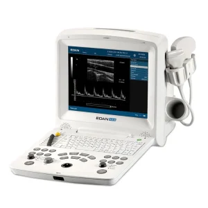 DUS60 Digital Ultrasound Machine with PW Doppler Imaging